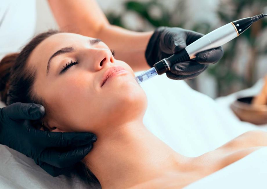MICRONEEDLING 