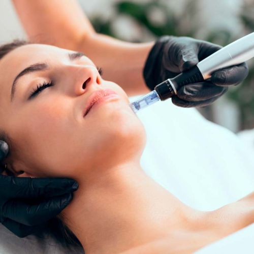 MICRONEEDLING